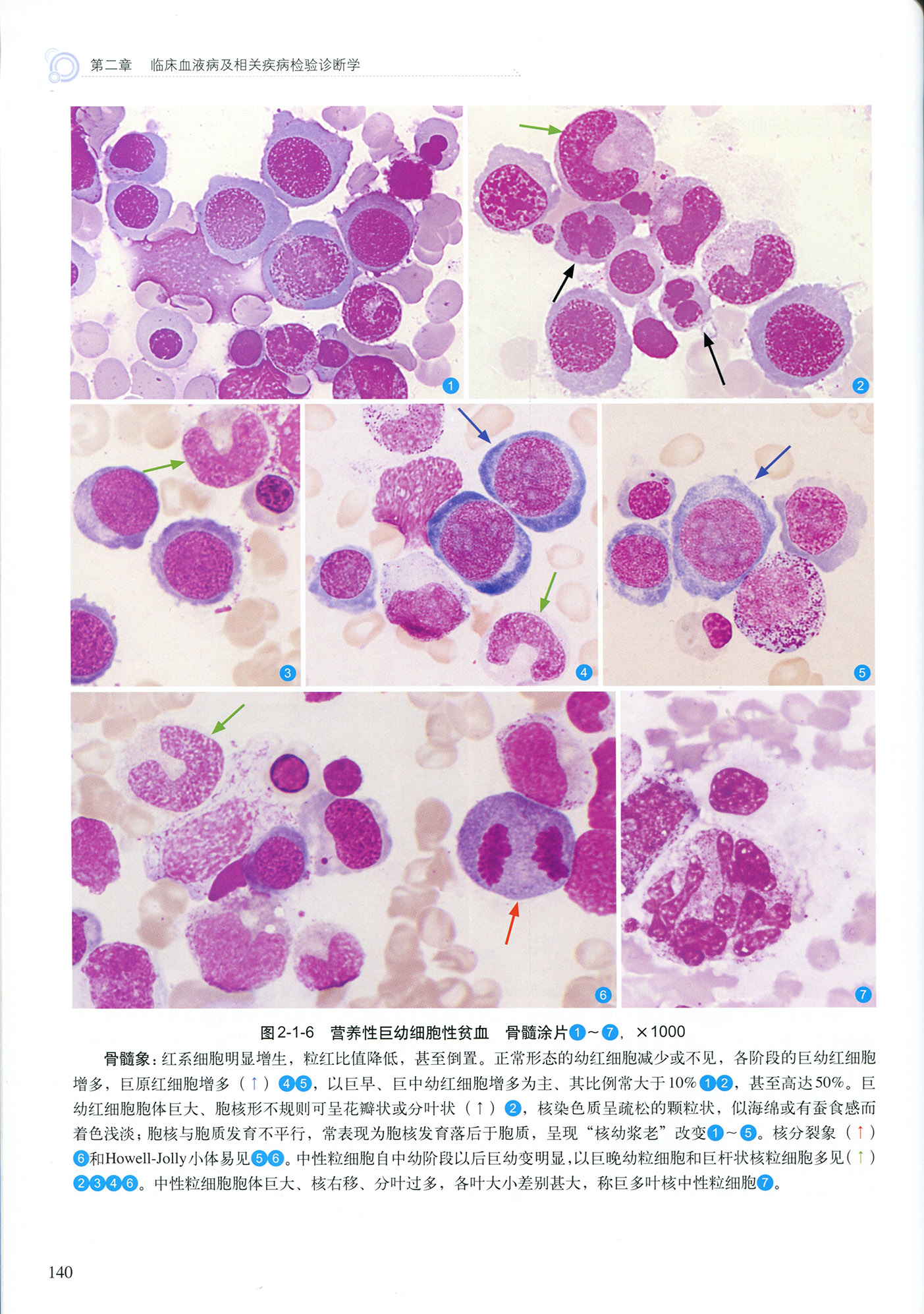 了解一下，巨细胞病毒感染_澎湃号·湃客_澎湃新闻-The Paper